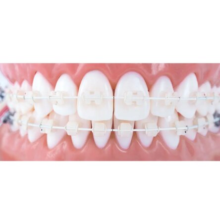 U ortho Niti Tooth color wire-Rectangular Lower19x25
