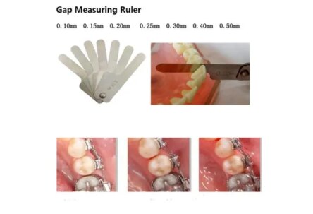 Divine Medicare Orthodontic Inter-proximal Gauge