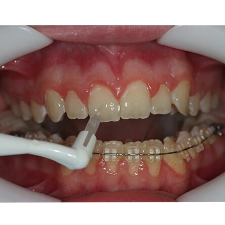 Reliance Ortho LB Primer 3 Gms Without Fluoride