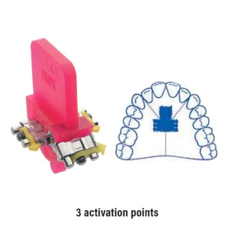 Leone 3D Screw with 3 Activation 16 mm 1/pk – A0930-16