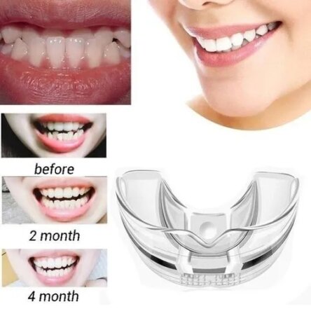 Divine Medicare Orthodontic Trainer & Retainer