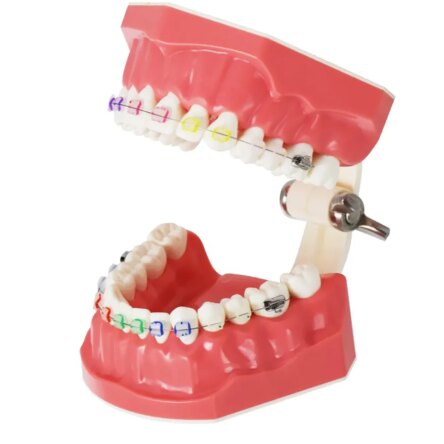 Identical Orthodontic Patient Education Model (Ceramic) – M3002