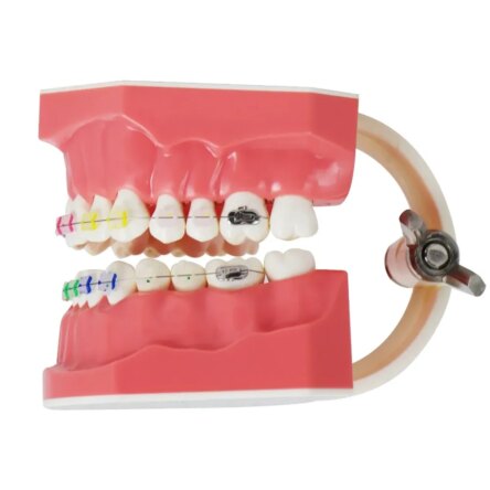 Identical Orthodontic Patient Education Model (Ceramic) – M3002