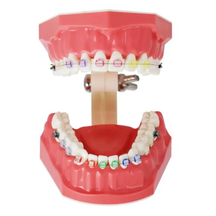 Identical Orthodontic Patient Education Model (Ceramic) – M3002