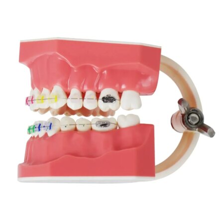 Identical Orthodontic Patient Education Model (Ceramic) – M3002