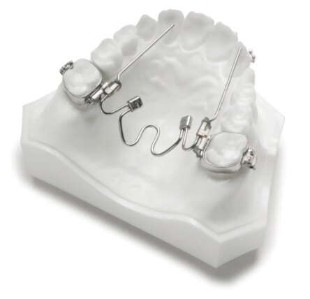 Ortho Organizers Nitanium Palatal Expander 2 Appliance – 42 mm