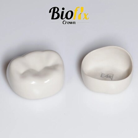 Kids-e-Dental BioFlx Posterior Crown Professional Kit (80 Crowns)