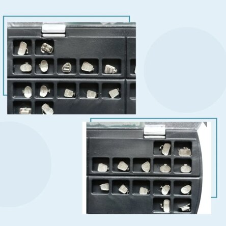 U Ortho Lingual Brackets 018 – STB